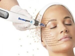 dermapen4